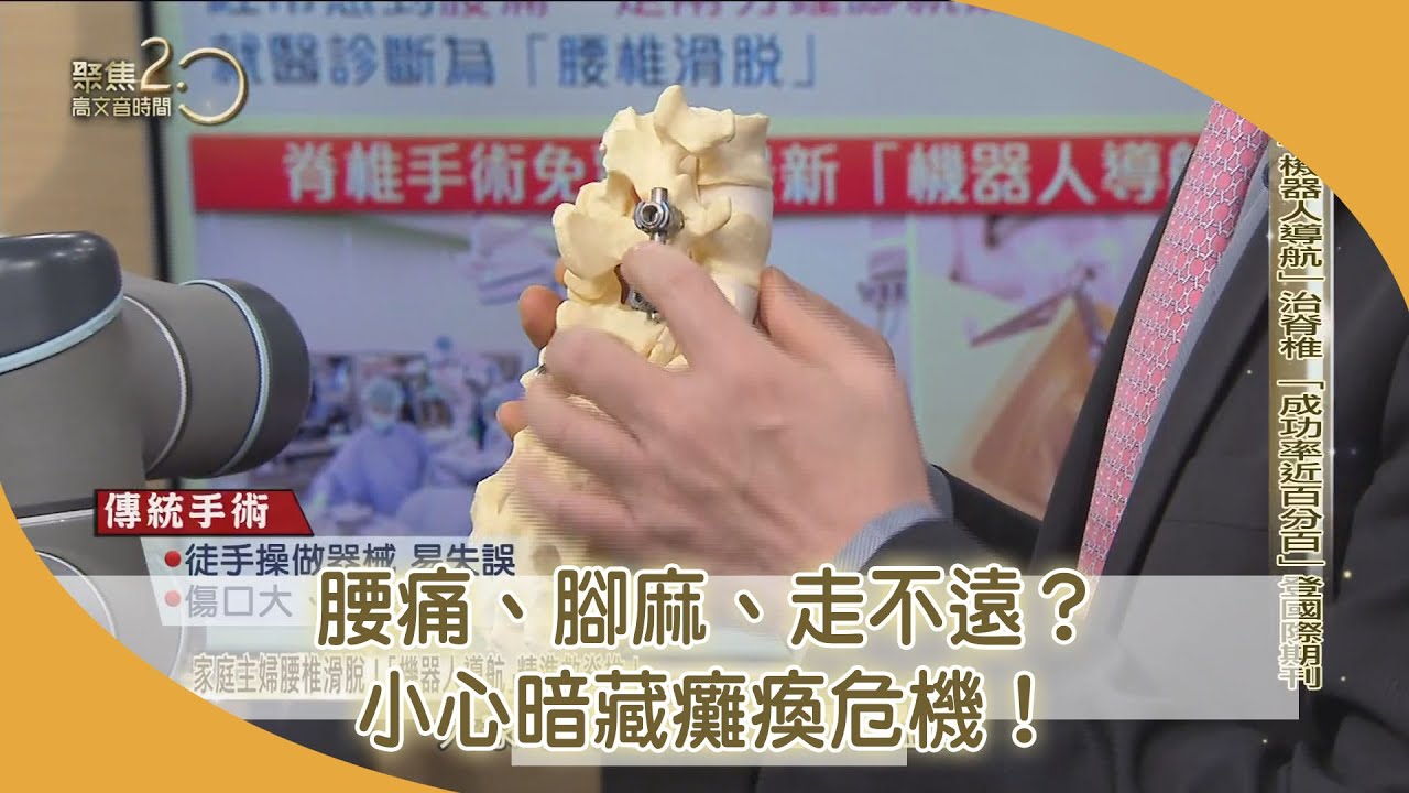 腰痛、腳麻、走不遠？「機器人導航」精準救脊椎！「成功率近百分百」登國際期刊！【聚焦2.0】第421集