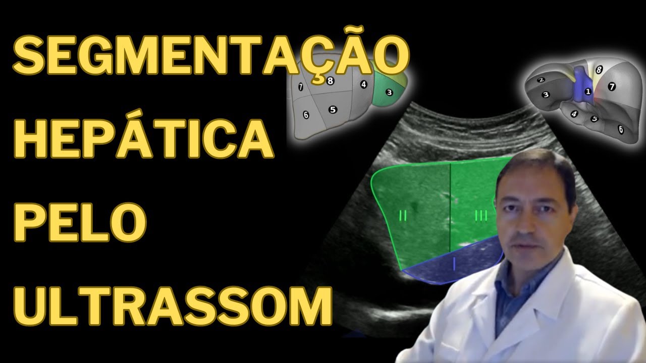Aprenda de uma vez a Segmentação Hepática pelo Ultrassom