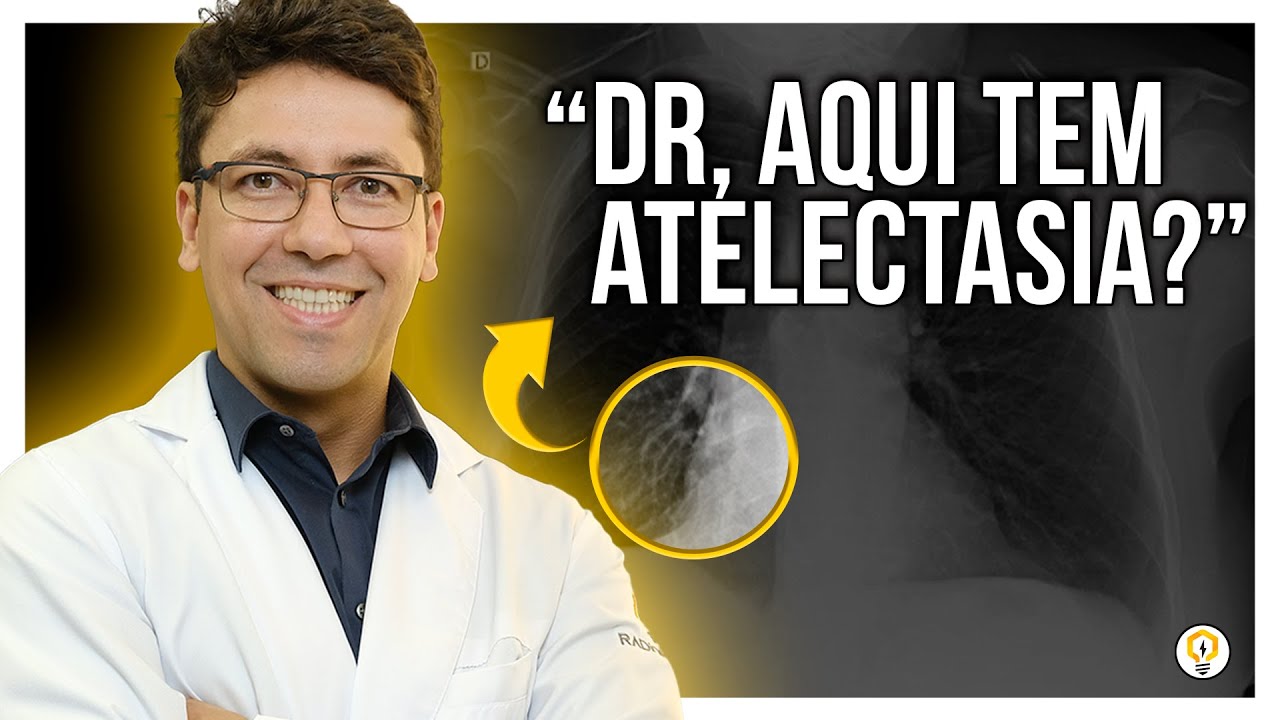 Como Identificar se é ATELECTASIA em RADIOGRAFIA