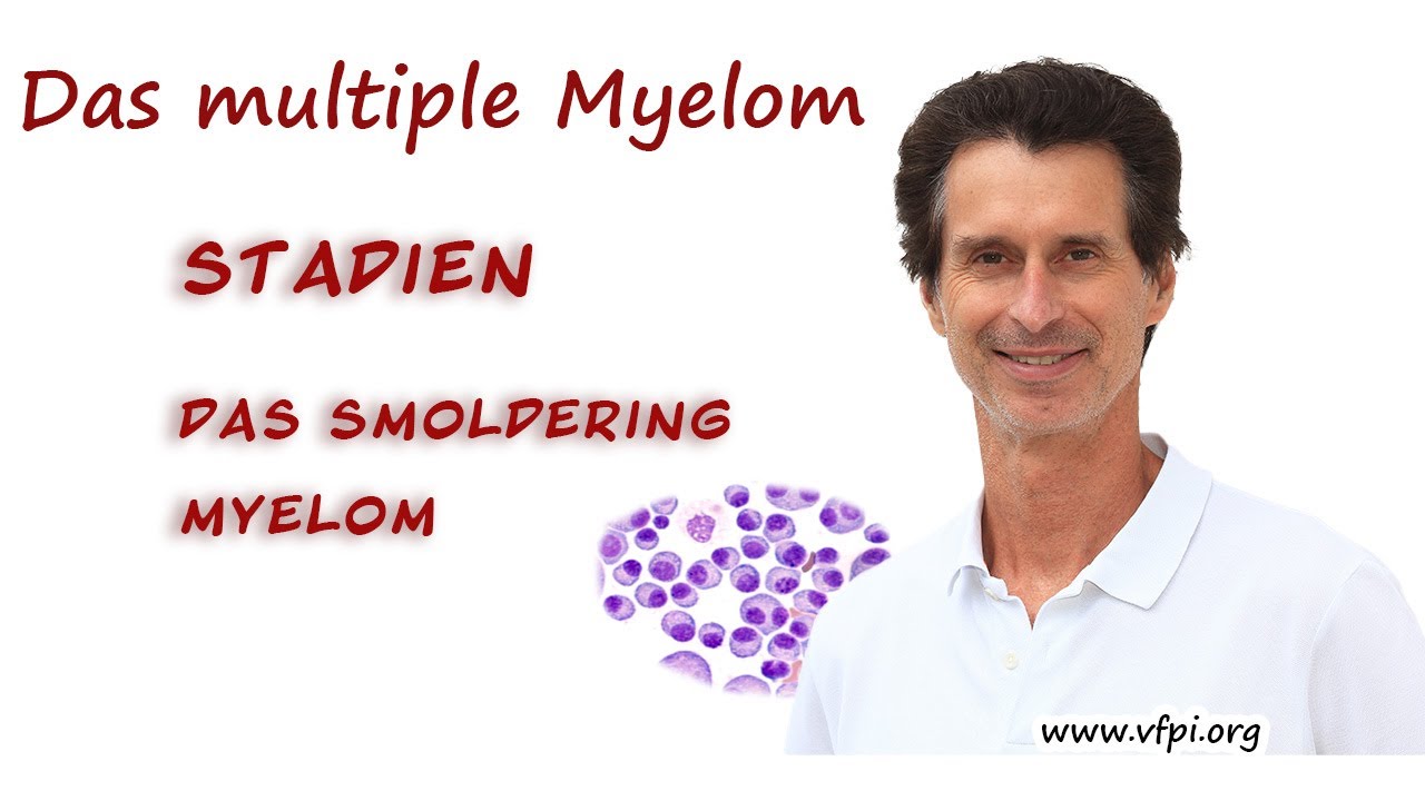 Multiples Myelom Stadien: von MGUS zum smoldering Myelom