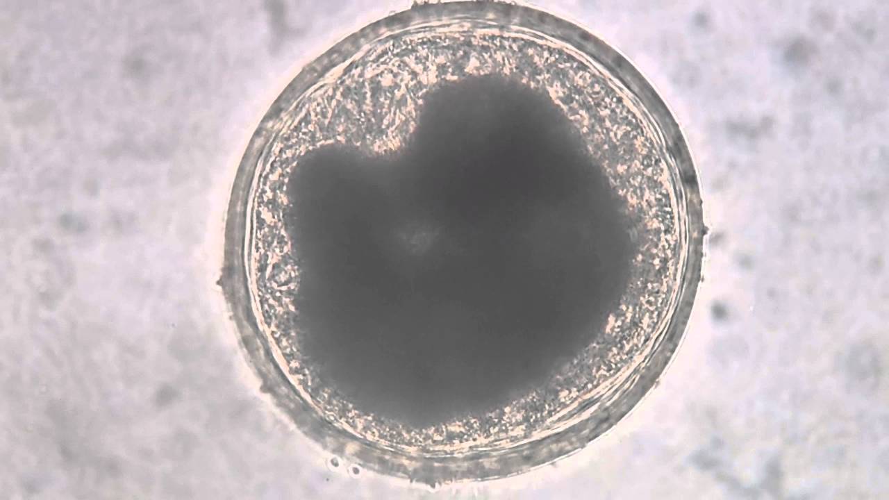 Encysted Metacercaria from a Freshwater Mussel 40X