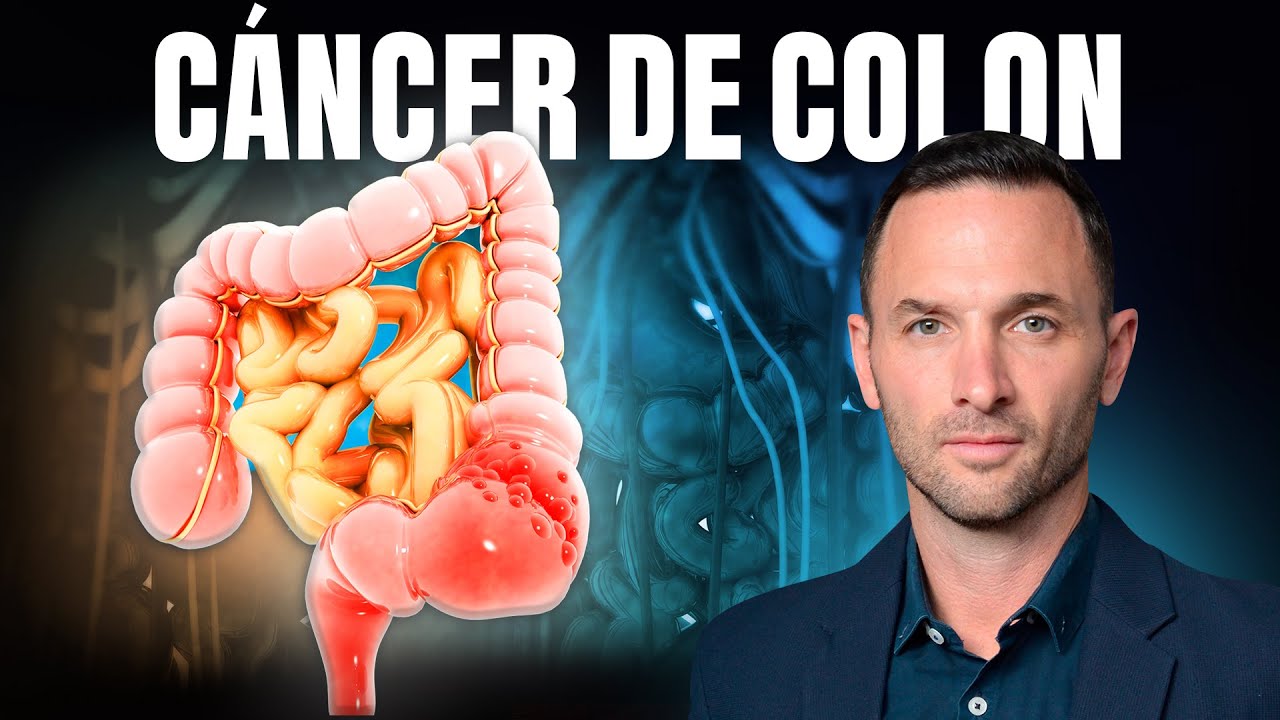 P&Oacute;LIPOS INTESTINALES, el mejor amigo del C&Aacute;NCER DE COLON &iexcl;Vence y previene A TIEMPO!