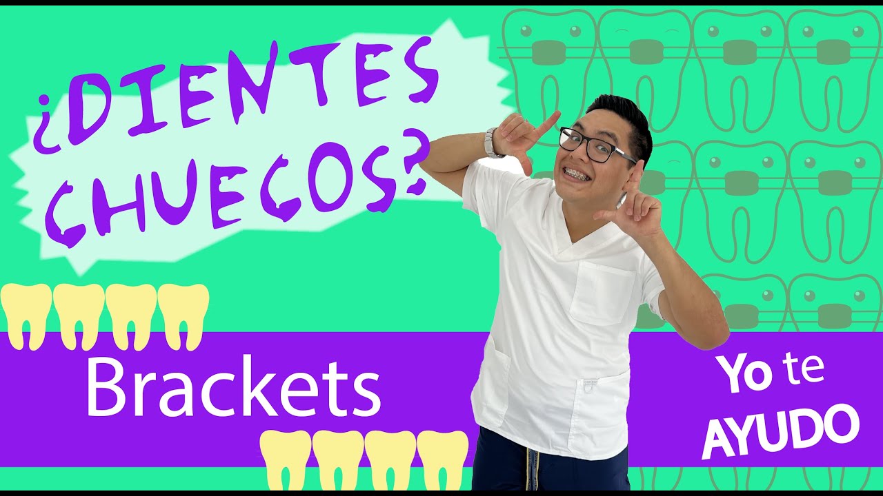 As&iacute; es COMO se 𝗣𝗢𝗡𝗘𝗡 los 𝐁𝐑𝐀𝐂𝐊𝐄𝐓𝐒 𝐌𝐄𝐓𝐀𝐋𝐈𝐂𝐎𝐒 - Instalaci&oacute;n de Brackets Paso a Paso (Video en 🔴 𝑽𝑰𝑽𝑶)🤗