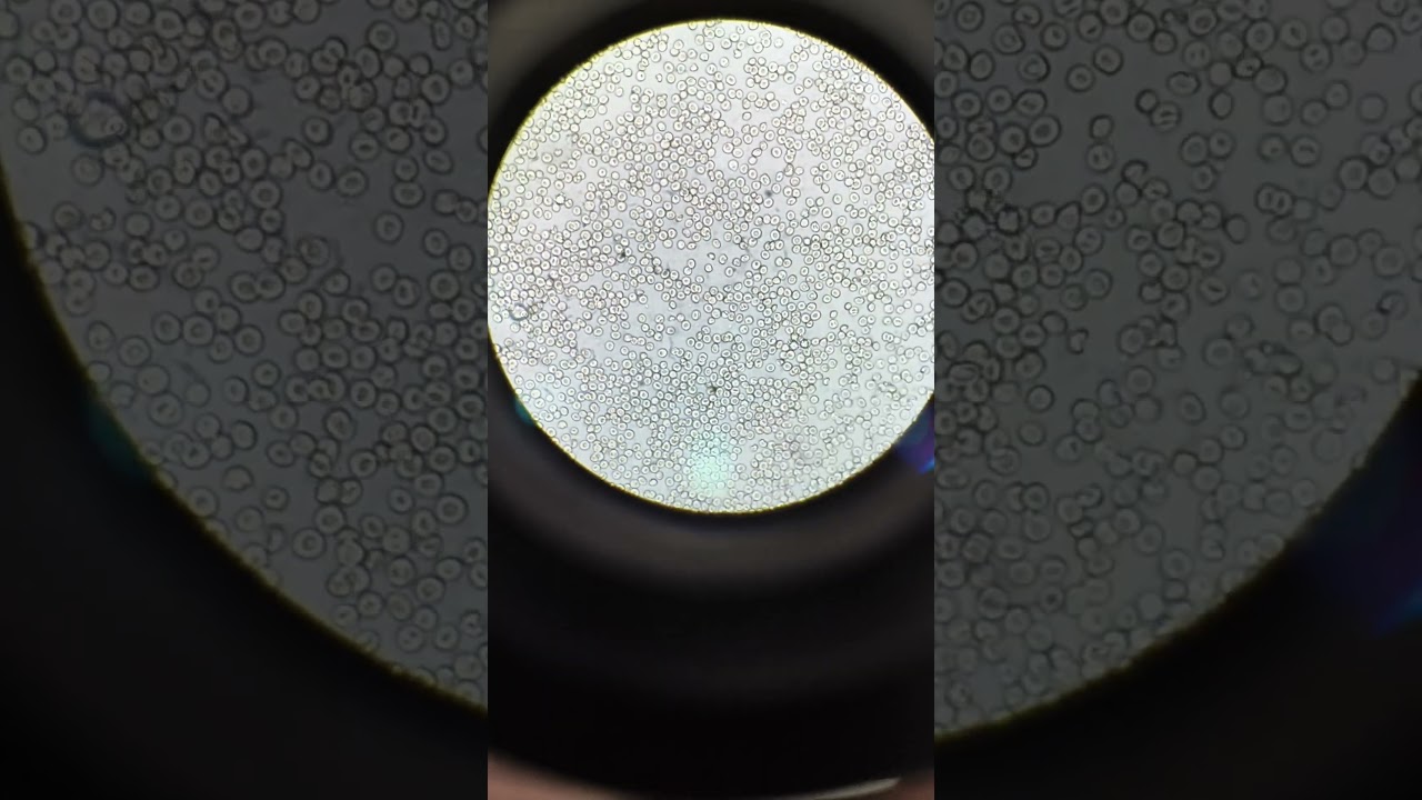 Indirect Coombs Test (ICT) #microscope