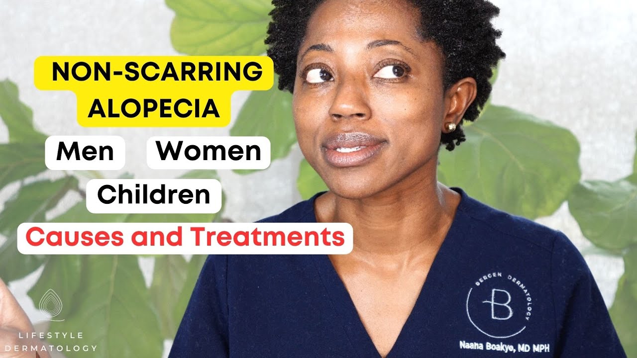 Non Scarring Alopecia Causes and Treatment: Men, Women and Children