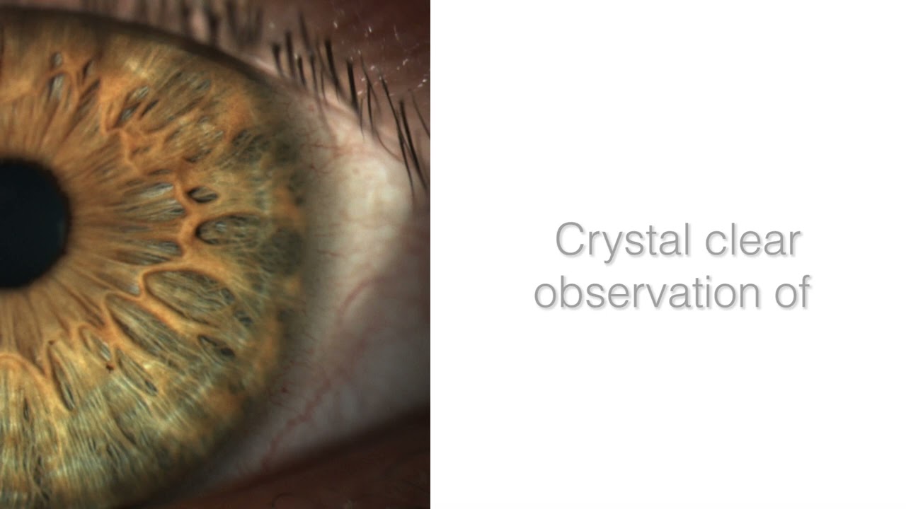 TAKAGI 700GL Slit Lamp  Elegant and accurate with personalised ergonomics