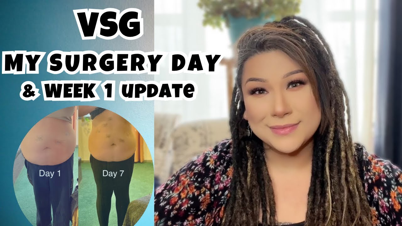 VSG SURGERY DAY (outpatient) | WEEK 1 POST OP - WEIGHT LOSS SURGERY RECOVERY