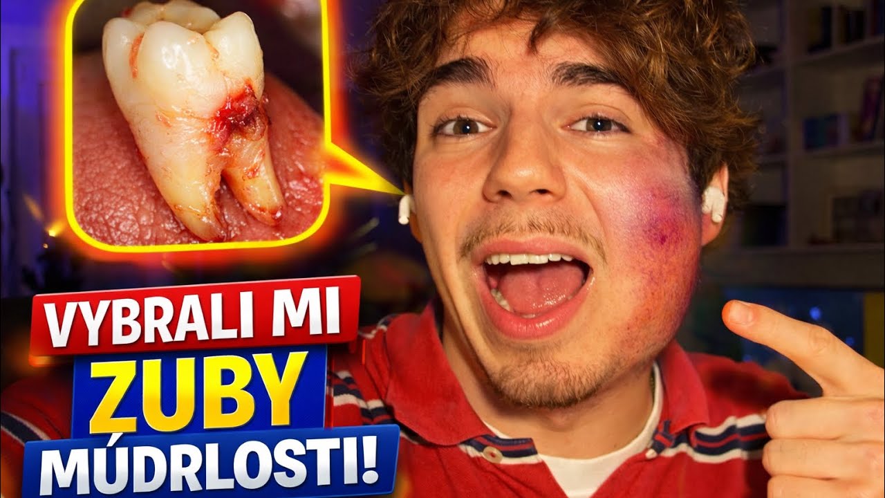 TRHANIE ZUBOV M&Uacute;DROSTI! - vlog #05