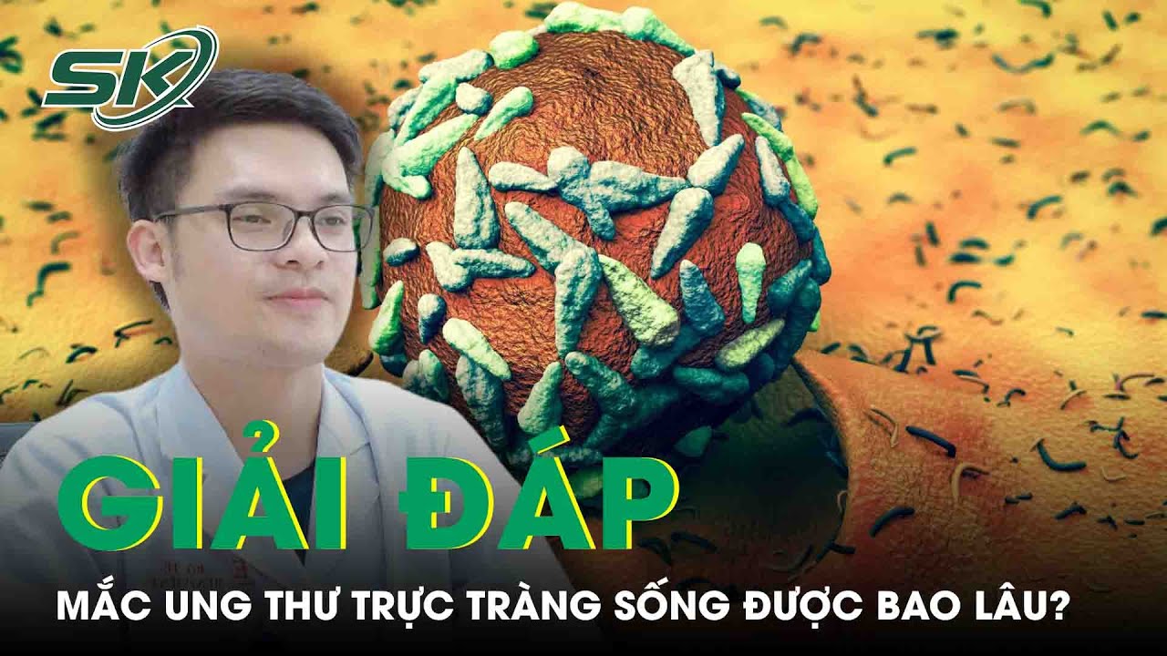 Mắc ung thư trực tràng sống được bao lâu? | SKĐS