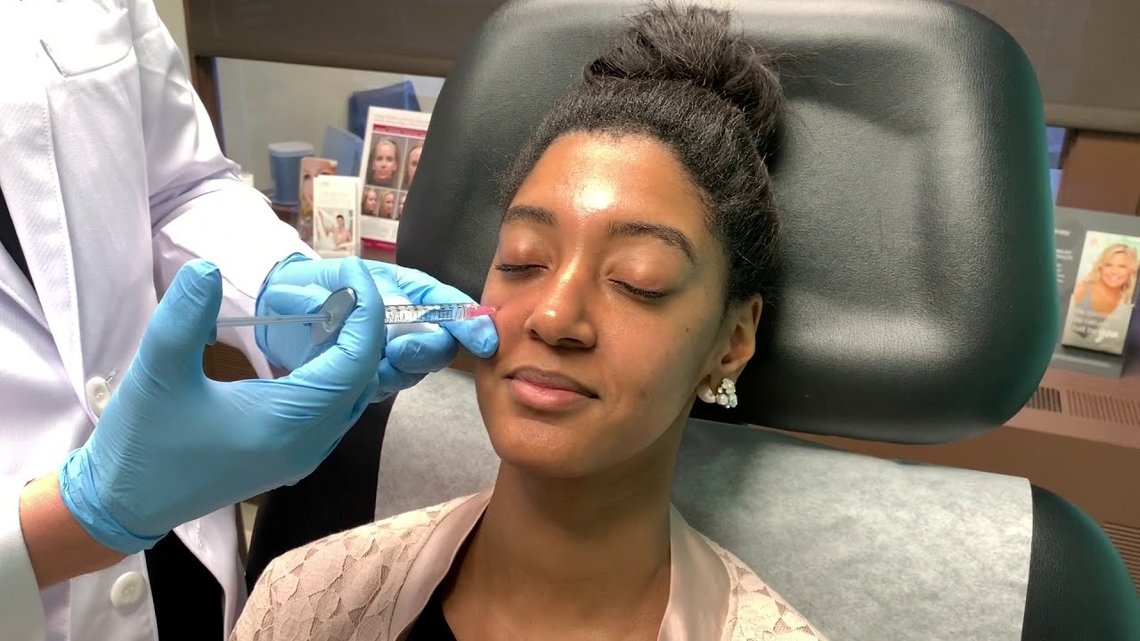 Using Fillers to Contour the Cheeks
