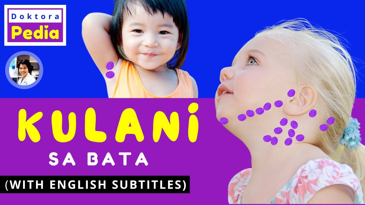 KULANI sa BATA | KULANI sa LEEG | KULANI sa ULO ng BABY | KULANI: SANHI AT LUNAS | DOKTORA PEDIA