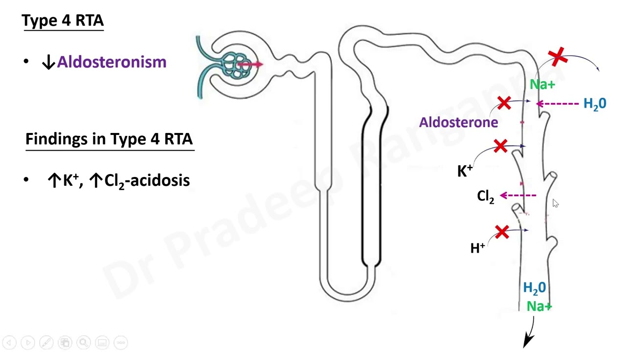 RTA (Renal Tubular Acidosis)