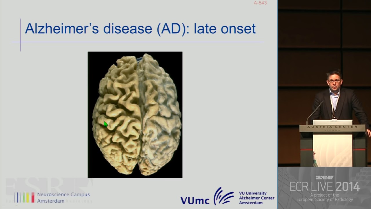 Neuro - Neuroimaging in dementia 3