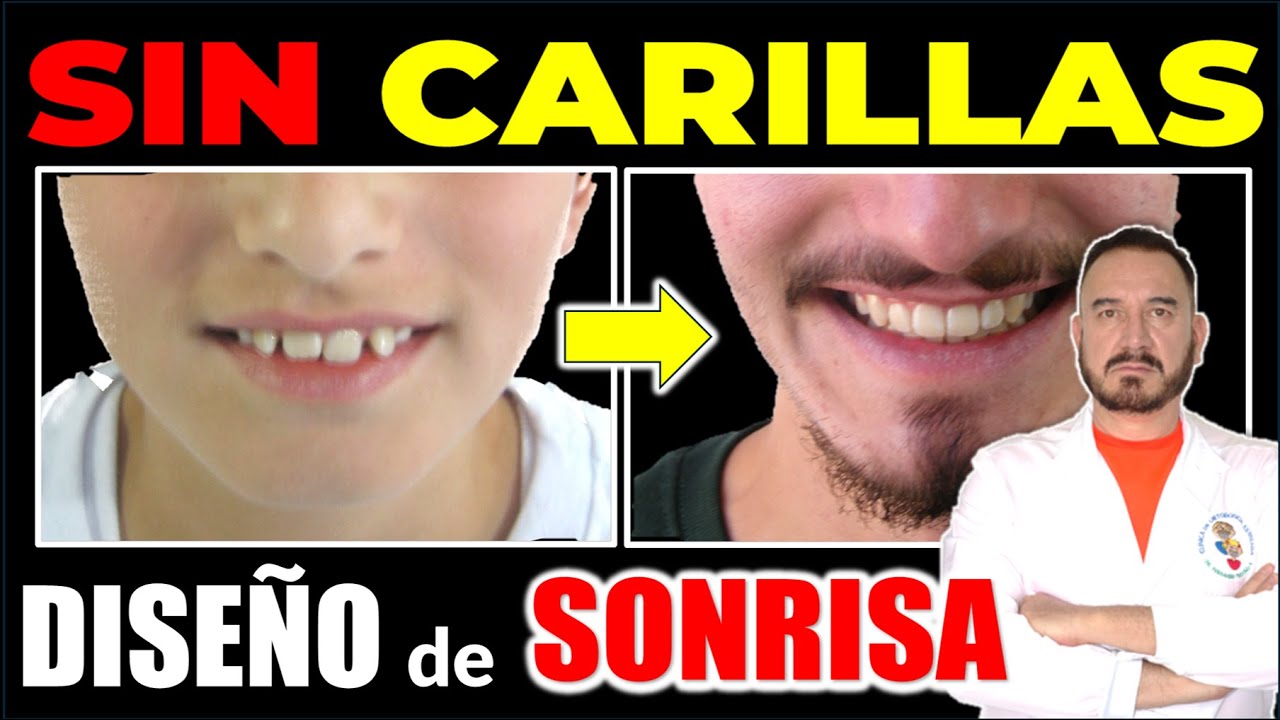 Factores Clave para un DISEÑO de SONRISA Estética que NO SABÍAS