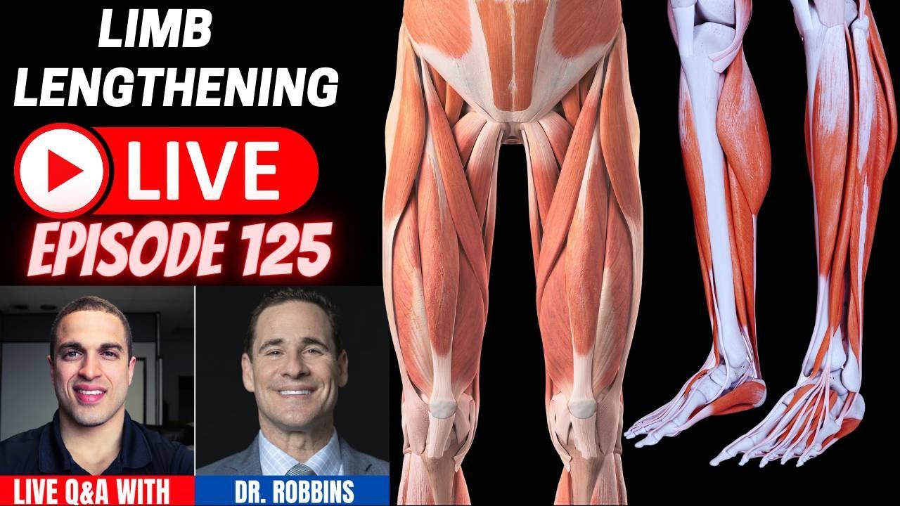 LL LIVE Ep 125 - Q&A w/ Limb Lengthening Surgeon - Dr. Robbins