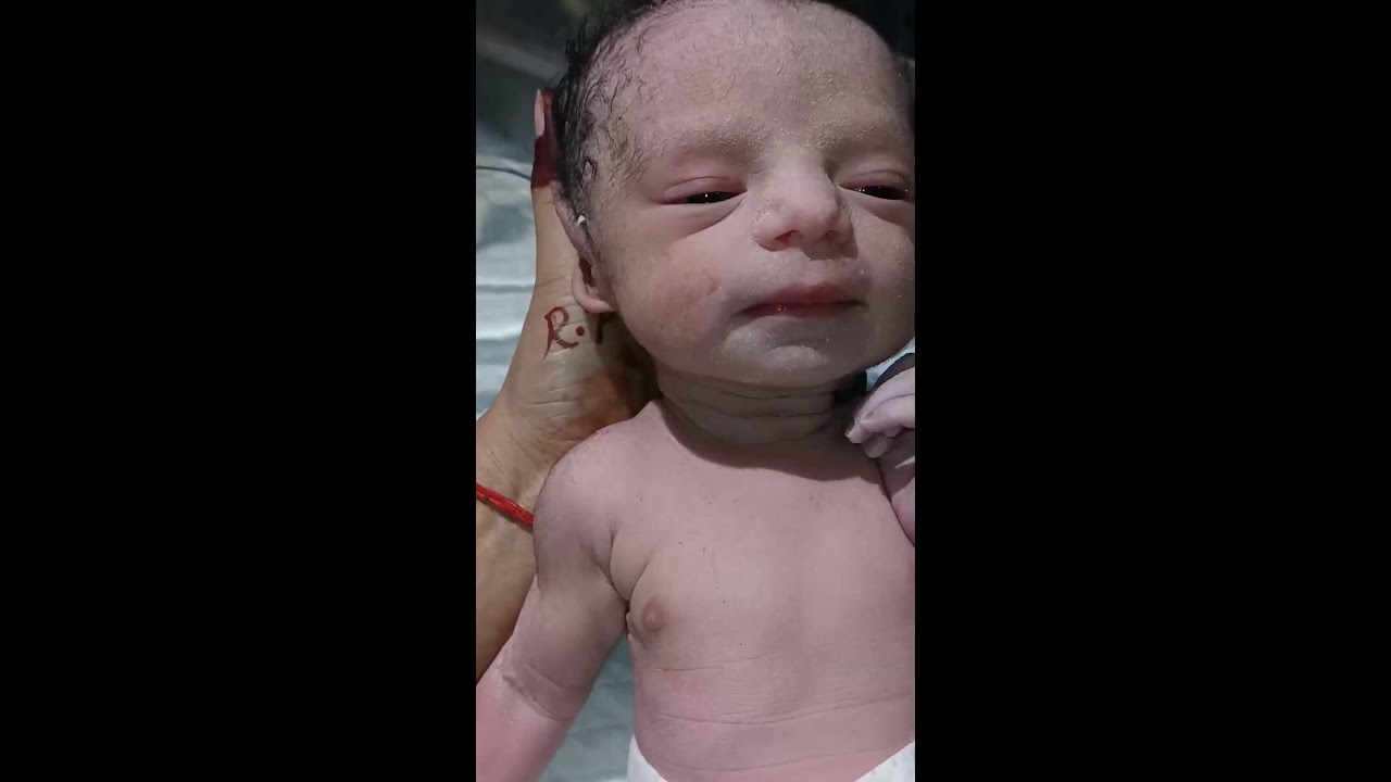 NEWBABAY TUCHNING Live Stream//newborn baby live//babies reaction live//baby nicu live// cutebaby