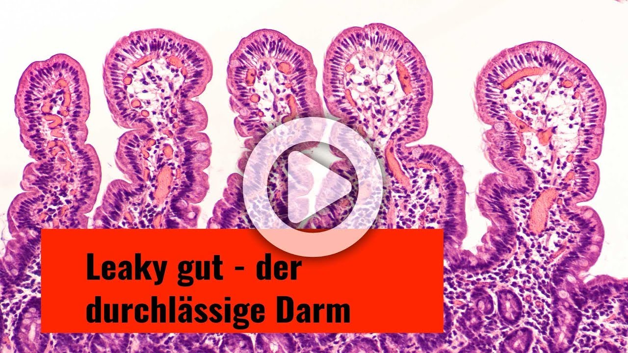 Leaky gut - der durchlässige  Darm