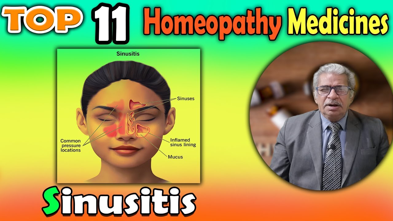 Sinusitis: Symptoms and #homeopathy Treatment -- Dr P S Tiwari