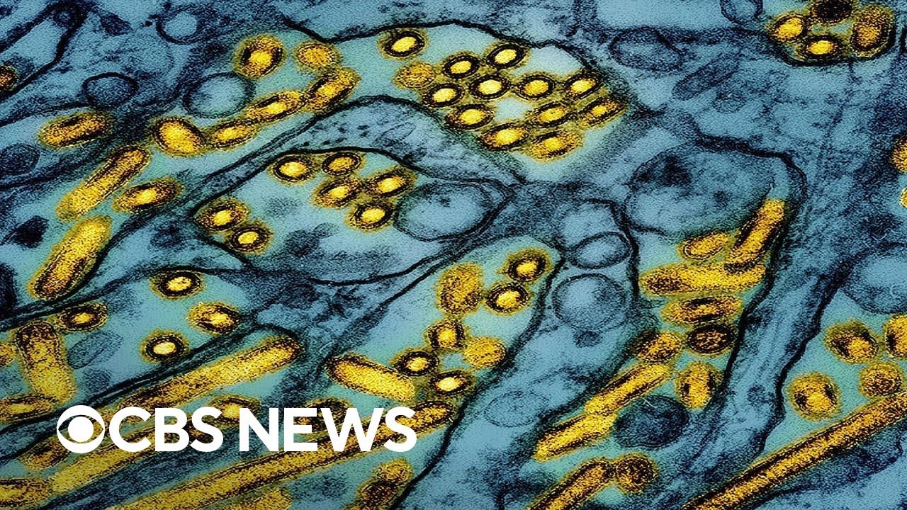 Severe human U.S. case of H5N1 bird flu, California declares emergency