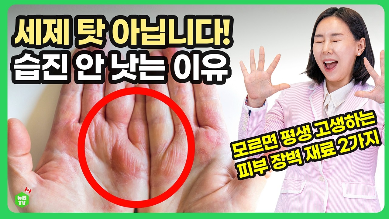 주부습진, 연고 발라도 재발하는 '근본적인 이유'! 피부 장벽 살리는 요소 크림과 영양제