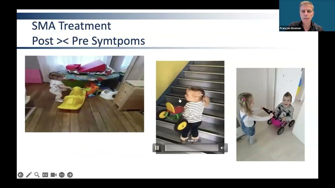Advancing Newborn Screening with Deep Sequencing: Lessons from the BabyDetect Project