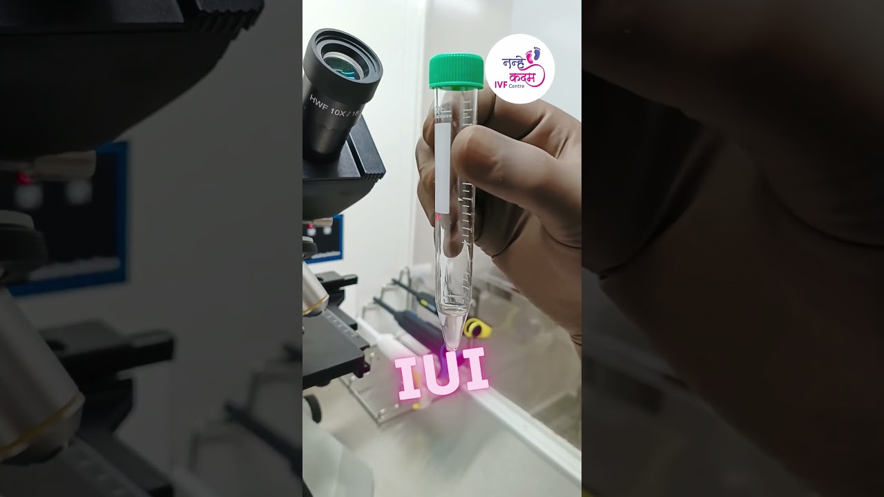 IUI Treatment for pregnancy | IUI कैसे किया जाता है | Dr. Suman Bhooker