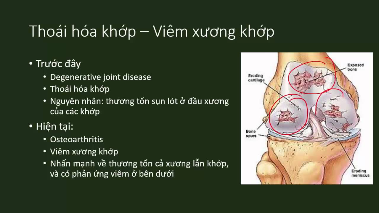 [Y6] Điều trị đau phần 1 - Lý thuyết (pain management)