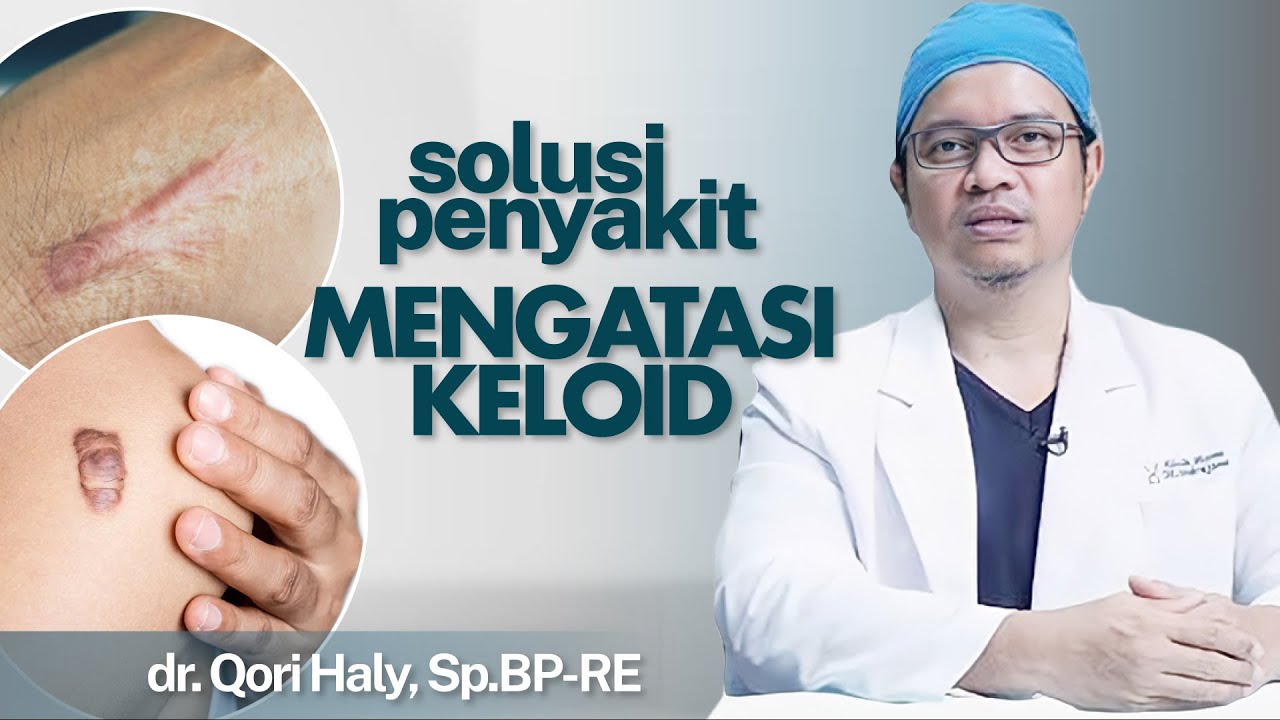 Keloid (Bekas Luka) Mengganggu Penampilan? Ini Cara Mengatasinya | Kata Dokter#116