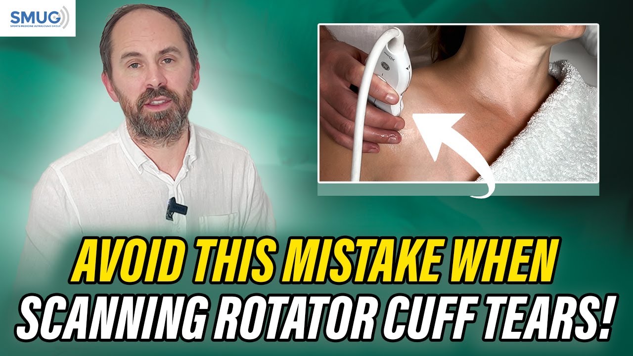 3 Common Mistakes to Avoid When Diagnosing Rotator Cuff Tears on Ultrasound! PART 01