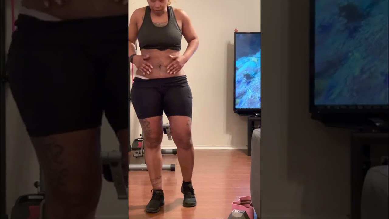 6wk post AbEX with SonoBello update after working out! 🥵👀