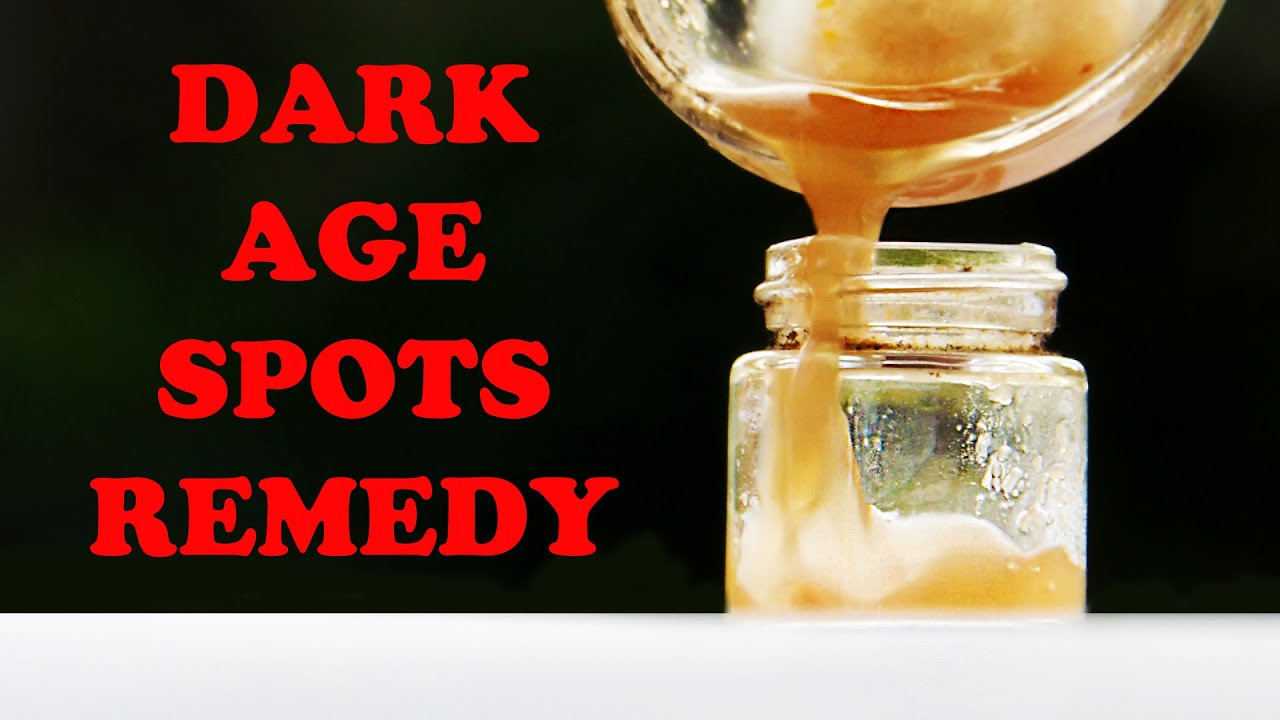 NATURAL HOME REMEDIES FOR DARK SPOTS ON FACE ON FACE || REMOVE BLACK AGE SPOTS ON SKIN NATURALLY