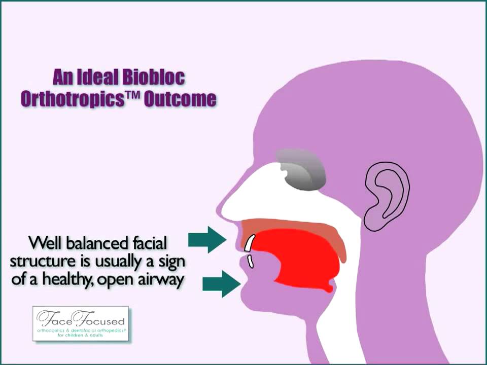 Your Airway - Is it affected by Orthodontic treatment?
