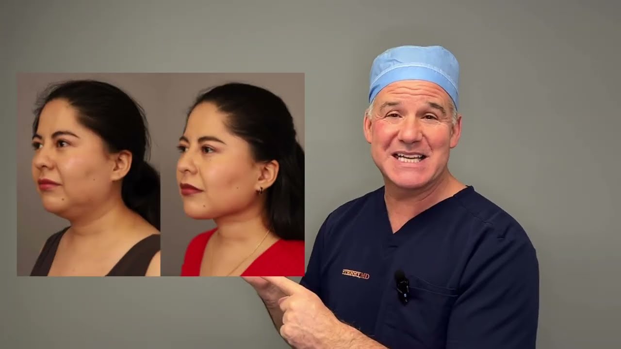 Mini Neck Lift