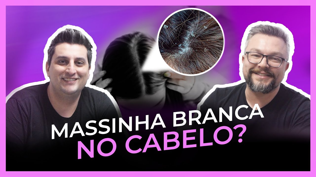 COMO ACABAR COM MASSINHA BRANCA NO CABELO - 6 MINUTOS DE BELEZA EP#02