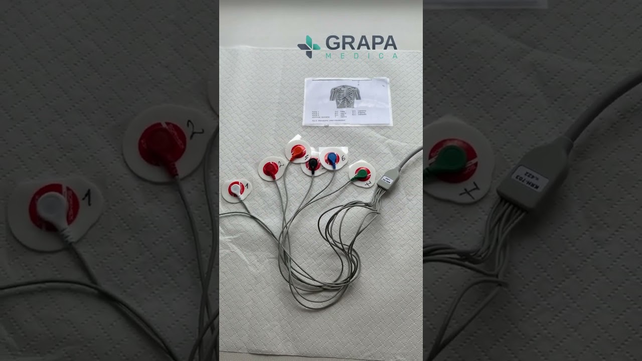 Holter EKG