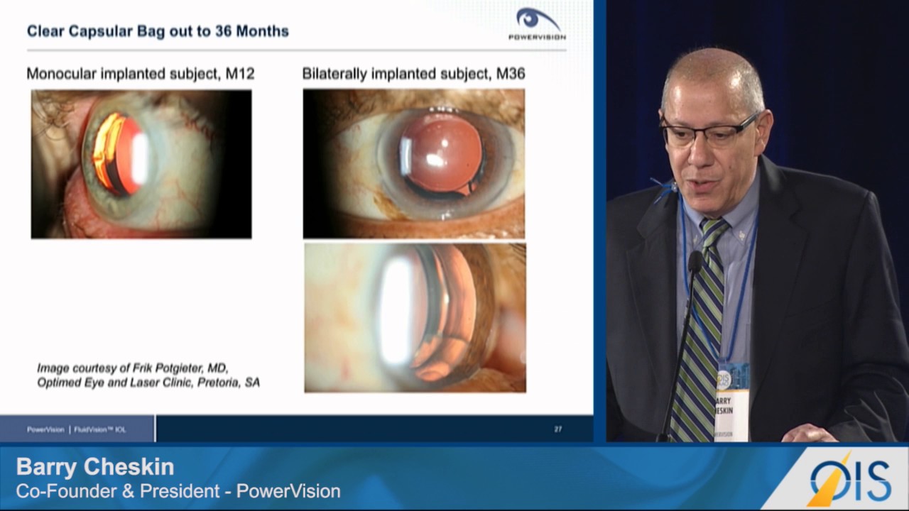 FluidVision: Designed to Restore True Accommodation (OIS@AAO 2016)