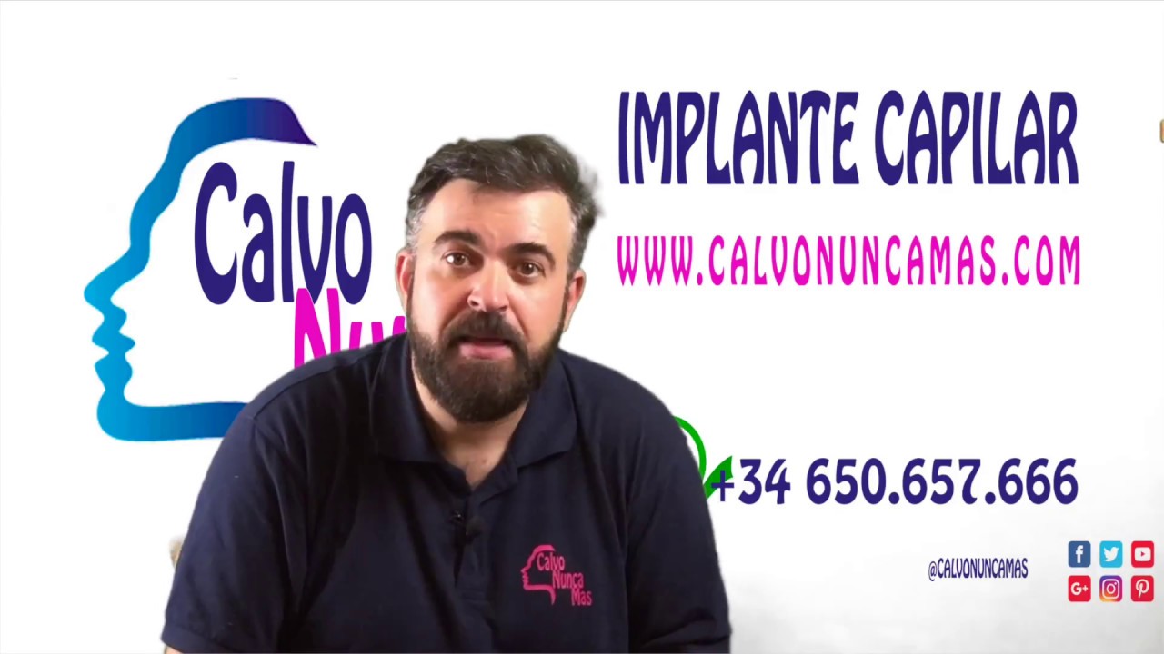 Trasplante Capilar &iquest;Qu&eacute; es Calvonuncamas? 1 - Parte