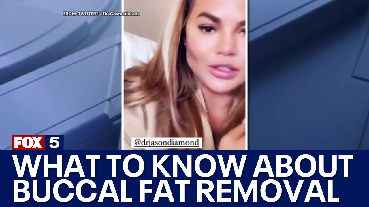Buccal Fat Removal: Why it's popular and the risks that come with it | FOX 5 DC