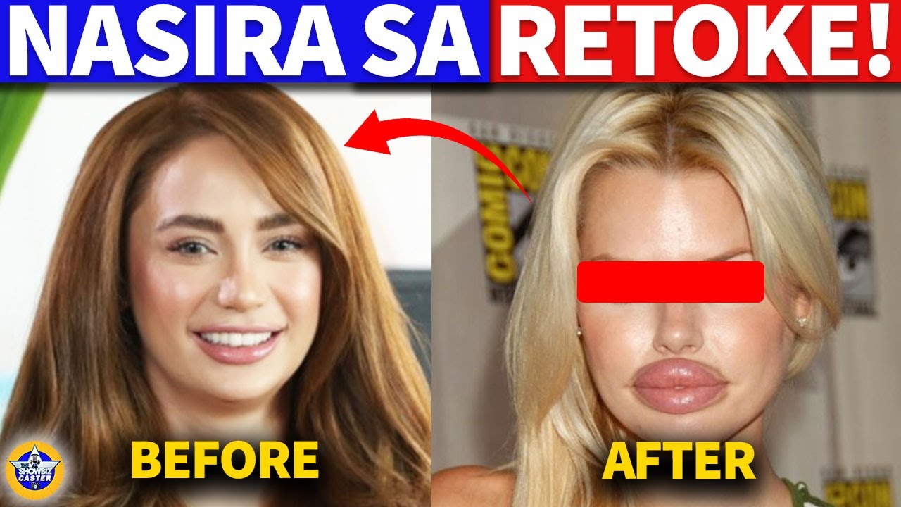 5 Artista sa Pilipinas na nasira ang mukha dahil sa retoke!