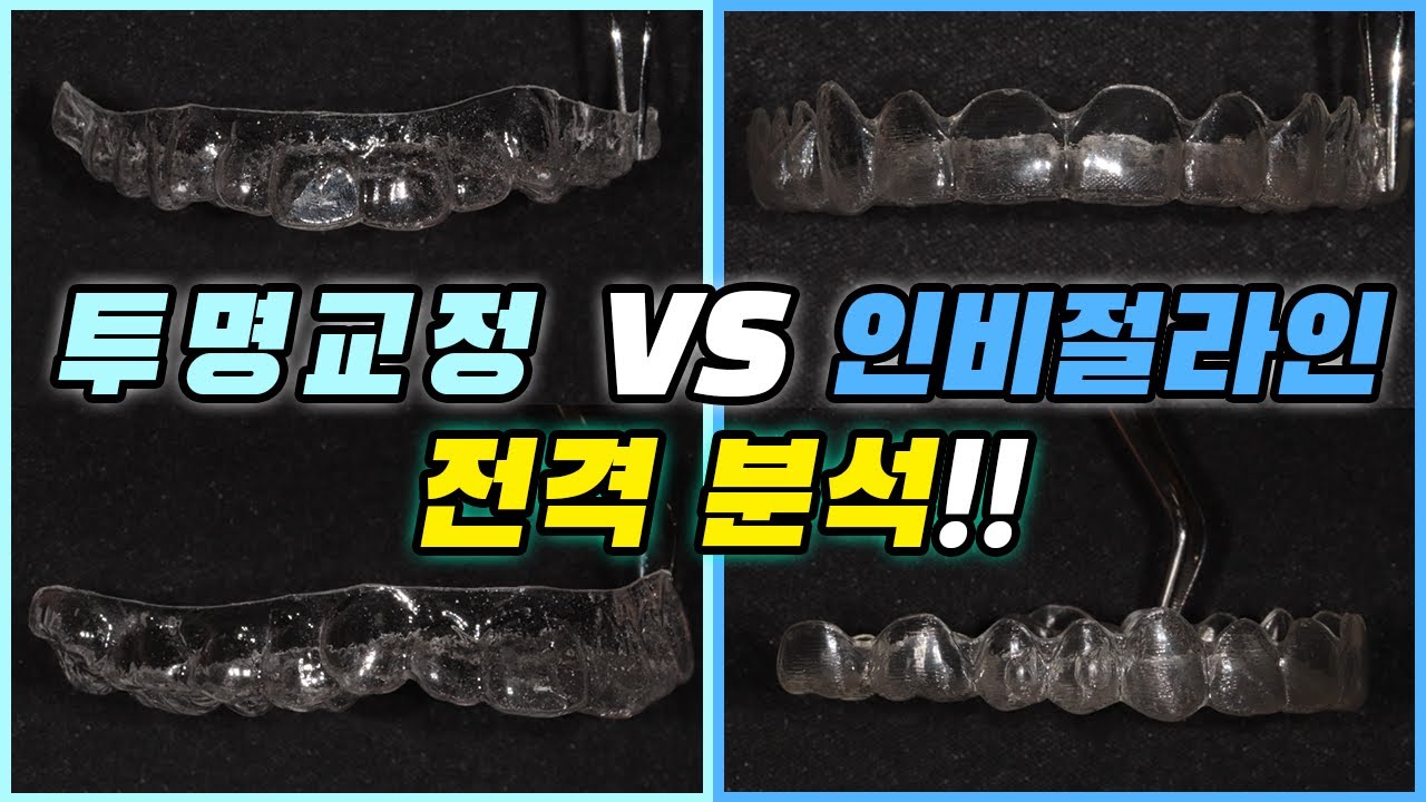 투명교정과 인비절라인의 차이점!  그것이 알고싶다!