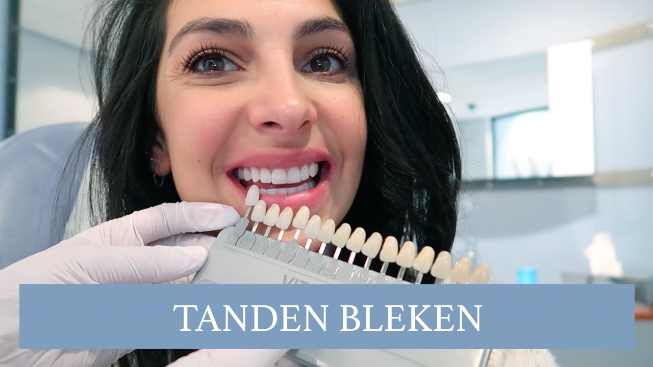 VLOG: TANDEN BLEKEN - Anna Nooshin