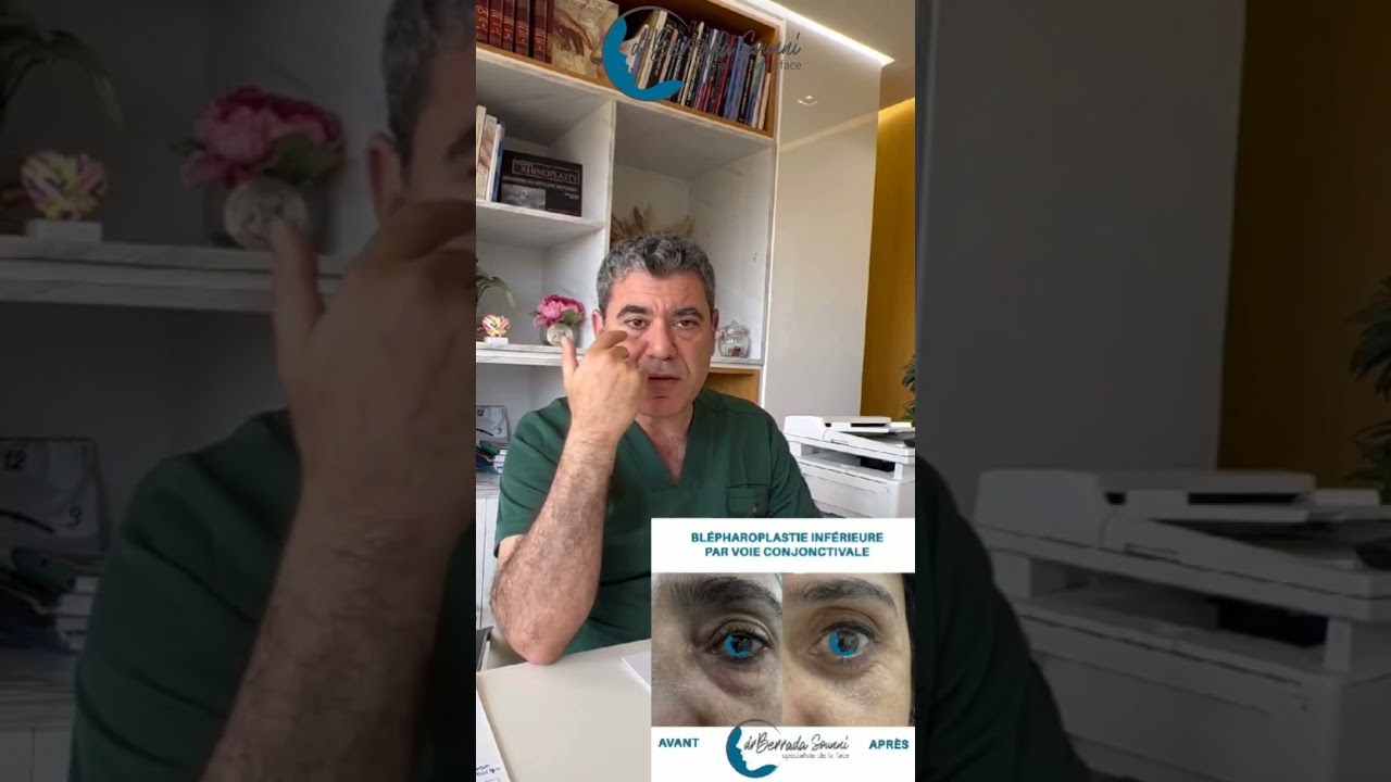 La blépharoplastie عملية تجميل الجفون