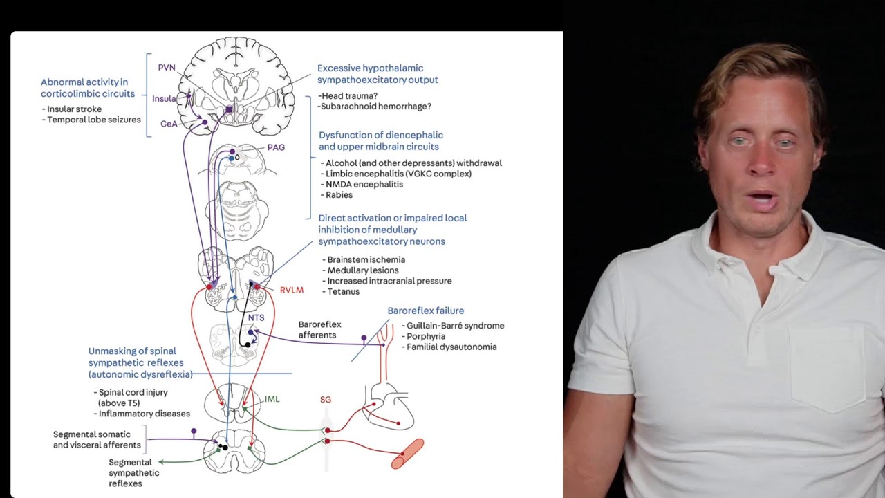 LIVE: Hyperadrenergic POTS: When the Brain Brakes Fail