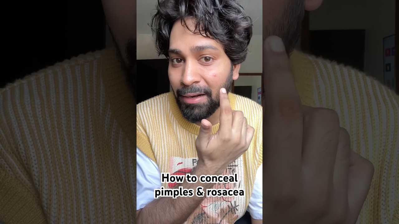 How to conceal big red pimples & rosacea