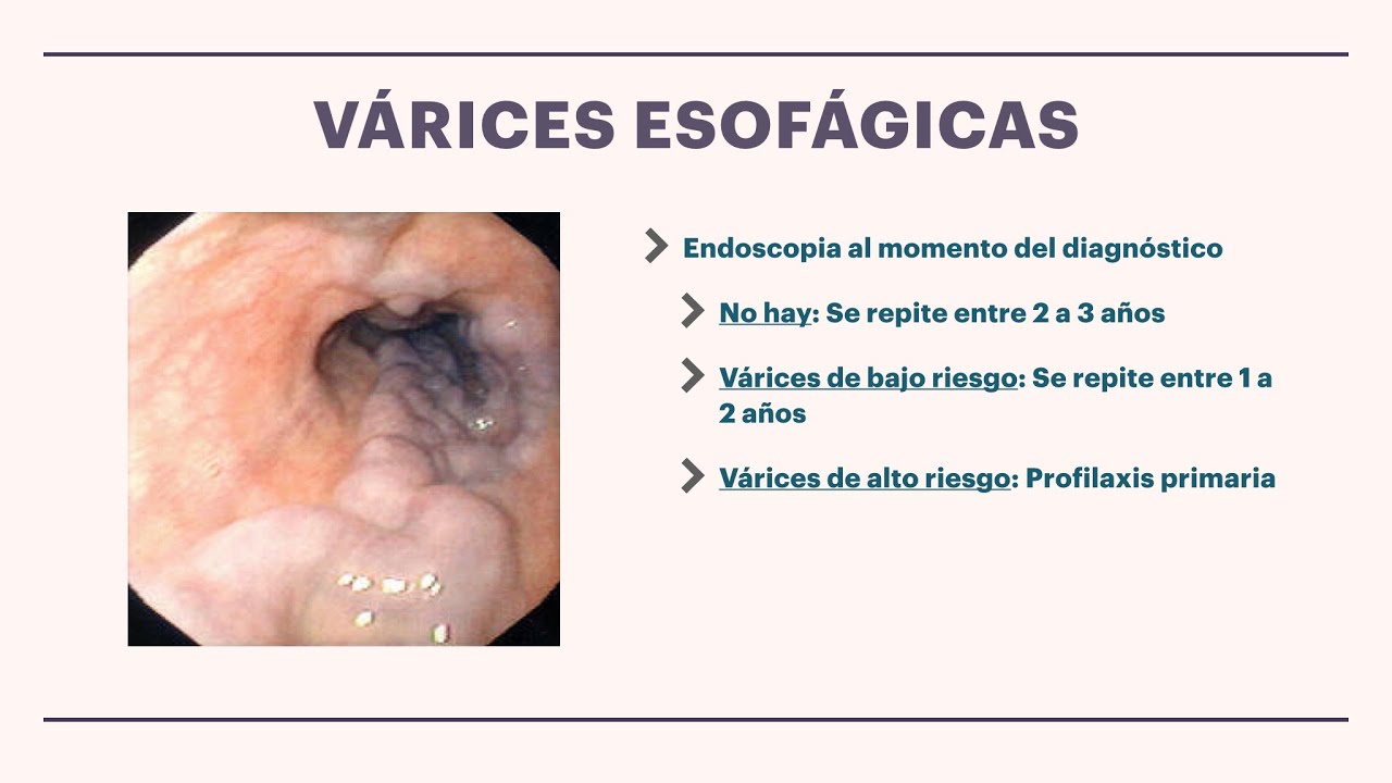 Complicaciones de la Cirrosis hepática
