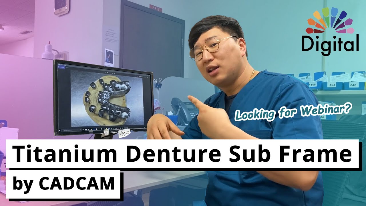 Digital Highlight - Ti Denture Sub Frame by CADCAM