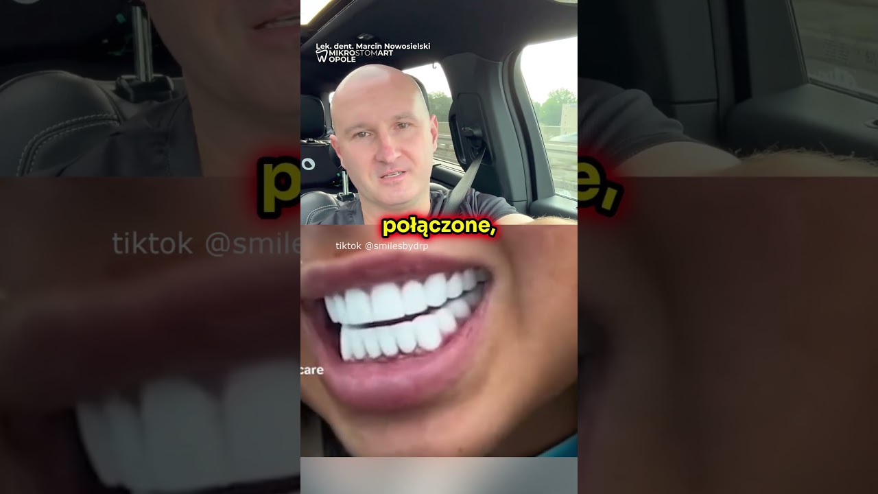 BLOK LIC&Oacute;WEK z TURCJI? 😱🦷 Dentysta: TO PODSTĘP OSZUST&Oacute;W! (UCIEKAJ, NIM PRZYKLEJĄ!)