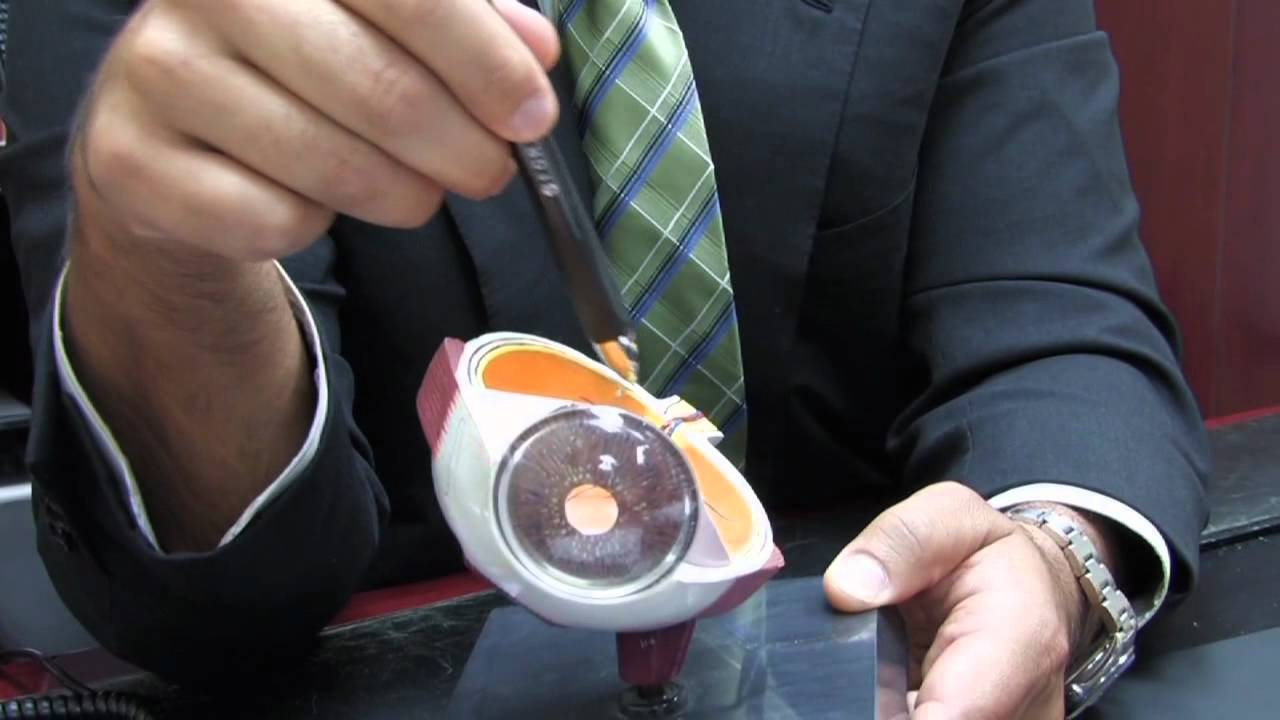 Stem Cell Research: Macular Degeneration