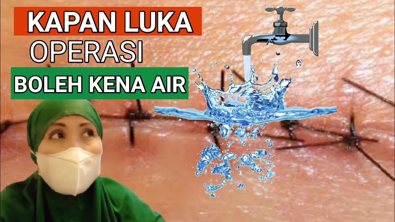 KAPAN LUKA OPERASI BOLEH KENA AIR - HARI KE BERAPA JAHITAN LUKA BOLEH BASAH