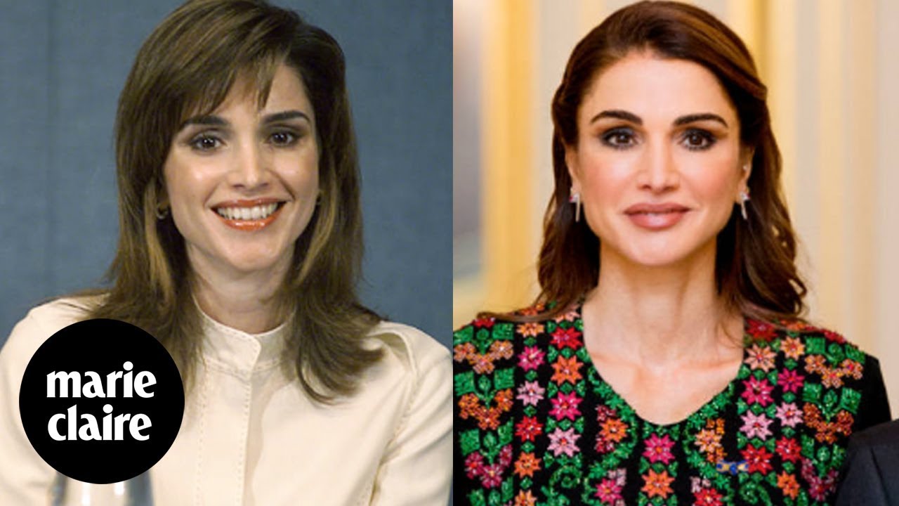 Rania de Jordania y sus retoques estéticos